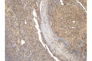 (ABIN570905) (6 μg/mL) staining of paraffin embedded Human Tonsil.