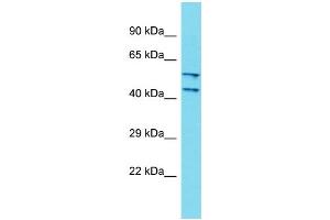 Host: Rabbit Target Name: DCAF4L2 Sample Type: Fetal Kidney lysates Antibody Dilution: 1. (DCAF4L2 抗体  (N-Term))