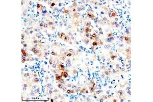 IHC analysis of Hsc70 using anti-Hsc70 antibody (ABIN7601962). (Hsc70 抗体  (AA 520-614))