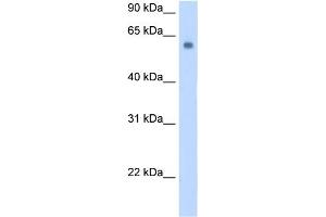 WB Suggested Anti-SLC1A4 Antibody Titration:  0. (SLC1A4 抗体  (C-Term))