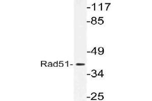 Western blot (WB) analysis of Rad51 antibody in extracts from 3T3 cells. (RAD51 抗体)