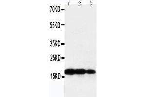 Anti-TNF beta antibody, Western blotting Lane 1: Recombinant Human TNF beta Protein 10ng Lane 2: Recombinant Human TNF beta Protein 5ng Lane 3: Recombinant Human TNF beta Protein 2. (LTA 抗体  (Middle Region))
