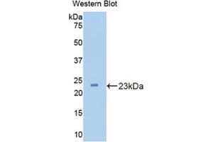 Western blot analysis of the recombinant protein. (CPN1 抗体  (AA 159-325))