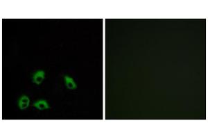 Immunofluorescence analysis of MCF-7 cells, using GPR103 antibody. (QRFPR 抗体  (Internal Region))