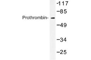 Image no. 1 for anti-Coagulation Factor II (thrombin) (F2) antibody (ABIN317606) (Prothrombin 抗体)