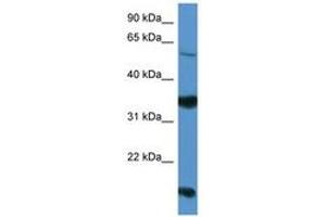Image no. 1 for anti-Netrin G2 (NTNG2) (AA 199-248) antibody (ABIN6746812) (Netrin G2 抗体  (AA 199-248))