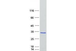 Western Blotting (WB) image for Zinc Finger, FYVE Domain Containing 21 (ZFYVE21) protein (Myc-DYKDDDDK Tag) (ABIN2735872)