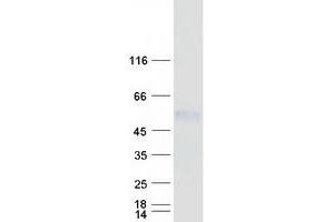 Western Blotting (WB) image for Protein Kinase Protein SgK196 (SGK196) protein (Myc-DYKDDDDK Tag) (ABIN2731931)