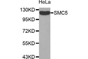 Western Blotting (WB) image for anti-Structural Maintenance of Chromosomes 5 (SMC5) antibody (ABIN1874872)