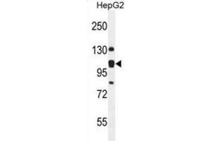 Western Blotting (WB) image for anti-KIAA0090 (KIAA0090) antibody (ABIN2995572) (KIAA0090 抗体)