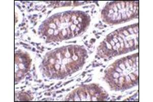 Immunohistochemistry of MICA in human colon tissue with this product at 10 μg/ml. (MICA 抗体  (C-Term))