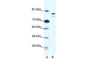 MCM8 antibody used at 0. (MCM8 抗体  (N-Term))