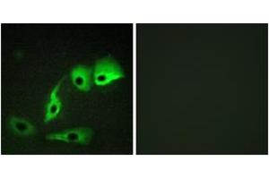 Immunofluorescence analysis of HepG2 cells, using Calmodulin (Ab-79/81) Antibody. (Calmodulin 1 抗体  (AA 46-95))