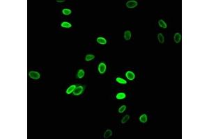 Immunofluorescent analysis of Hela cells using ABIN7139183 at dilution of 1:100 and Alexa Fluor 488-congugated AffiniPure Goat Anti-Rabbit IgG(H+L) (HIST1H2AG 抗体  (acLys5))