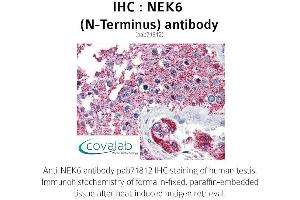 Image no. 2 for anti-NIMA (Never in Mitosis Gene A)-Related Kinase 6 (NEK6) (N-Term) antibody (ABIN1737252) (NEK6 抗体  (N-Term))