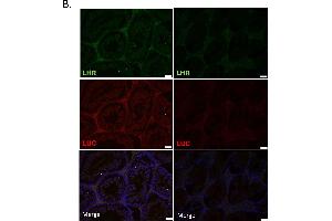 Pathology of F1B-TMIR mouse testis after busulfan injection.