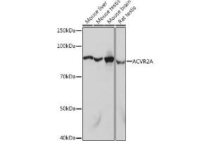 Western blot analysis of extracts of various cell lines, using A Rabbit mAb  at 1:1000 dilution.