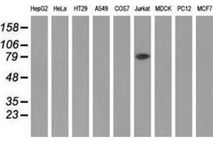 Western blot analysis of extracts (35 µg) from 9 different cell lines by using anti-ALDH1L1 monoclonal antibody. (ALDH1L1 抗体)