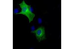 Image no. 6 for anti-B-Raf proto-oncogene, serine/threonine kinase (BRAF) antibody (ABIN1496952) (BRAF 抗体)