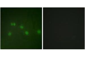 Immunofluorescence (IF) image for anti-Nuclear Receptor Subfamily 2, Group F, Member 2 (NR2F2) (AA 1-50) antibody (ABIN2889431) (NR2F2 抗体  (AA 1-50))