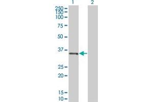 Western Blotting (WB) image for IL1B 293T Cell Transient Overexpression Lysate(Denatured) (ABIN1332322)