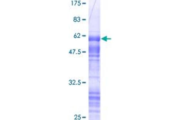 CRX Protein (AA 1-299) (GST tag)