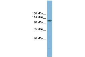 WB Suggested Anti-C14orf104 Antibody Titration: 0. (DNAAF2 抗体  (N-Term))