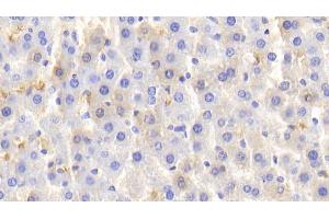 Detection of HB in Rat Liver Tissue using Polyclonal Antibody to Hemoglobin (HB) (Hemoglobin 抗体)