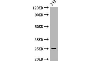 Western Blot Positive WB detected in: 293 whole cell lysate All lanes: Mad2L2 antibody at 1:2000 Secondary Goat polyclonal to rabbit IgG at 1/50000 dilution Predicted band size: 25 kDa Observed band size: 25 kDa (Recombinant MAD2L2 抗体)