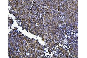 IHC analysis of KLF13 using anti-KLF13 antibody (ABIN7602036). (KLF13 抗体  (AA 56-260))
