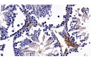 Immunohistochemistry (IHC) image for anti-Glycophorin A (GYPA) (AA 1-108) antibody (ABIN7441901)
