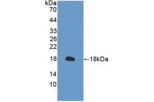 Detection of Recombinant PRDX2, Mouse using Polyclonal Antibody to Peroxiredoxin 2 (PRDX2) (Peroxiredoxin 2 抗体  (AA 6-164))