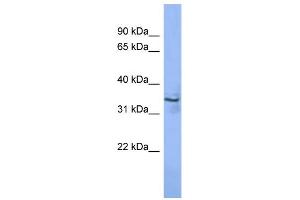 WB Suggested Anti-MAGEA2 Antibody Titration: 0. (MAGEA2 抗体  (N-Term))