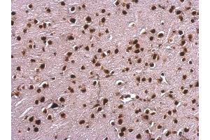 IHC-P Image Scaffold attachment factor B1 antibody detects Scaffold attachment factor B1 protein at nucleus on mouse fore brain by immunohistochemical analysis. (SAFB 抗体)