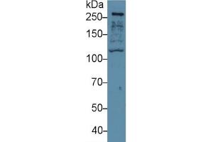 Rabbit Capture antibody from the kit in WB with Positive Control: Sample Human hela cell lysate.
