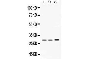 Western blot analysis of PSMA1 expression in rat testis extract ( Lane 1), mouse spleen extract ( Lane 2) and HEPG2 whole cell lysates ( Lane 3). (PSMA1 抗体  (C-Term))