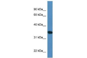 WB Suggested Anti-Upp2 Antibody   Titration: 1. (UPP2 抗体  (C-Term))