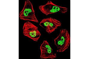 Fluorescent confocal image of Hela cell stained with TARDBP Antibody (N-term) (ABIN657685 and ABIN2846677). (TARDBP 抗体  (N-Term))
