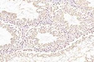Immunohistochemistry analysis of paraffin-embedded rat testis using,NXF2 (ABIN7074901) at dilution of 1: 3000 (NXF2 抗体)