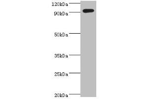 Western blot All lanes: SEMA4C antibody at 10 μg/mL + k562 whole cell lysate Secondary Goat polyclonal to rabbit IgG at 1/10000 dilution Predicted band size: 93 kDa Observed band size: 93 kDa