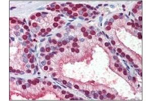 Immunohistochemistry (IHC) image for anti-Cellular Retinoic Acid Binding Protein 1 (CRABP1) (AA 1-137), (N-Term) antibody (ABIN400870) (CRABP1 抗体  (N-Term))