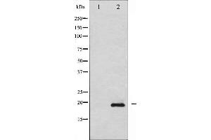 Western Blotting (WB) image for anti-Stathmin 1 (STMN1) (pSer15) antibody (ABIN6256152)