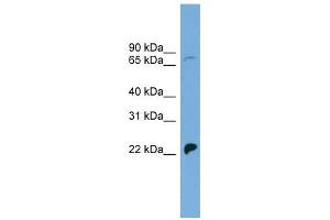 SLC5A5 antibody used at 1 ug/ml to detect target protein.