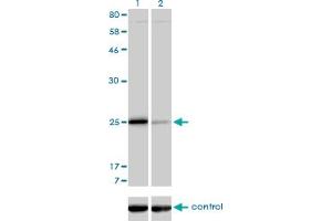 Western blot analysis of TNNI3 over-expressed 293 cell line, cotransfected with TNNI3 Validated Chimera RNAi (Lane 2) or non-transfected control (Lane 1). (TNNI3 抗体  (AA 102-210))