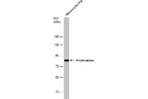 WB Image Mouse tissue extract (50 μg) was separated by 7. (Prothrombin 抗体  (N-Term))