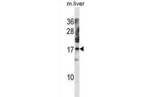 Western Blotting (WB) image for anti-NTF2-Related Export Protein 1 (NXT1) antibody (ABIN3001119)