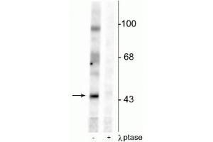 Western blot of rat testes lysate showing specific immunolabeling of the ~46 kDa EphrinB phosphorylated at Tyr331 in the first lane (-). (EPH Receptor B2 抗体  (pTyr331))