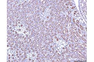 IHC analysis of PAP/ACP3 using anti-PAP/ACP3 antibody (ABIN7600122). (ACPP 抗体  (AA 150-386))