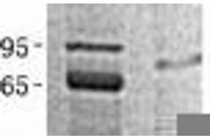 Western Blotting (WB) image for Peptidylprolyl Isomerase E (Cyclophilin E) (PPIE) (Transcript Variant 1) protein (His tag) (ABIN2712739)