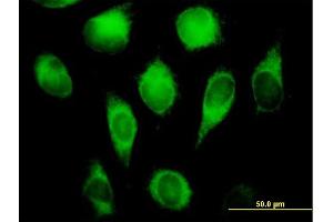Immunofluorescence of purified MaxPab antibody to CYB5R3 on HeLa cell. (CYB5R3 抗体  (AA 1-301))
